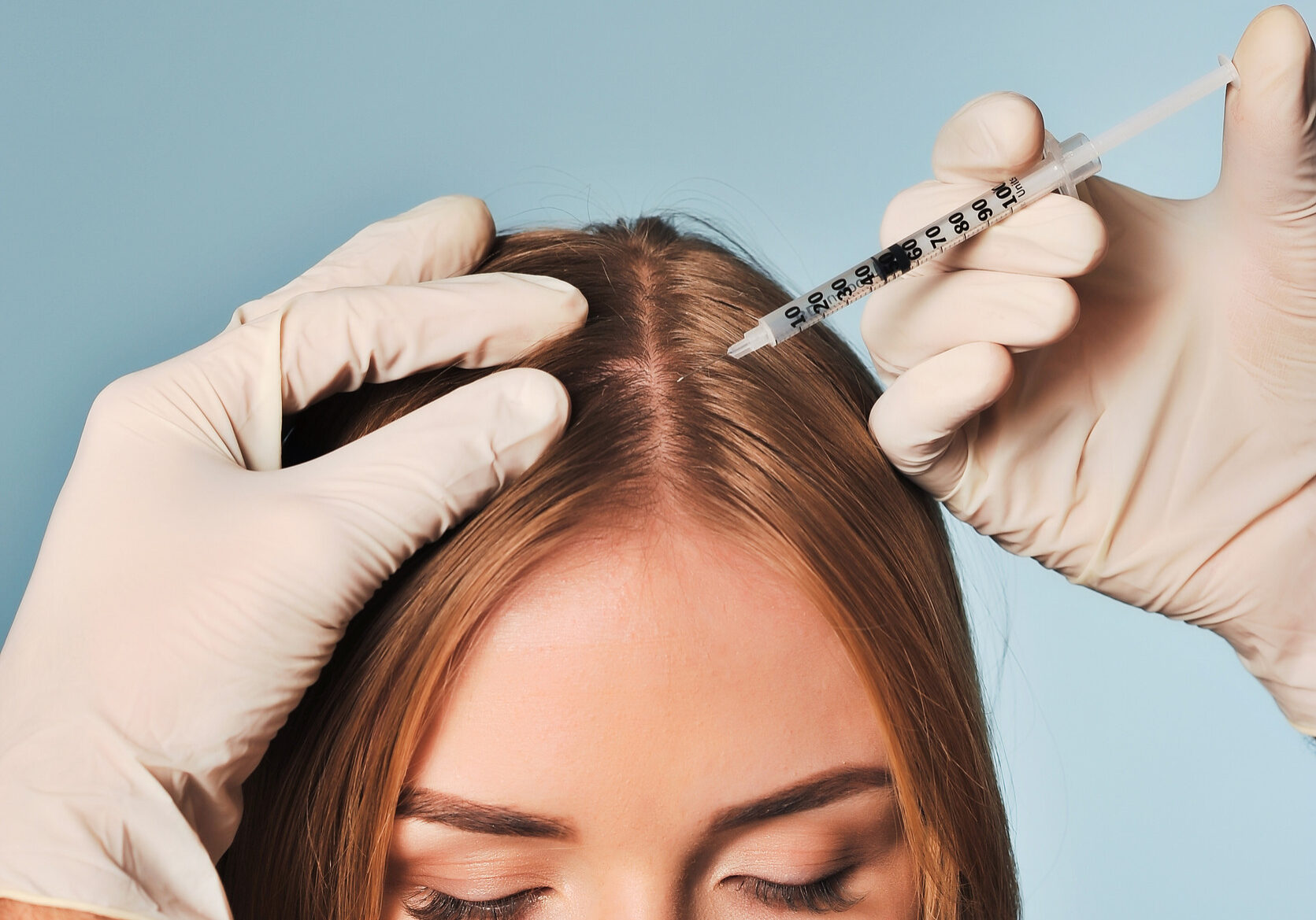 PRP Hair Restoration injection