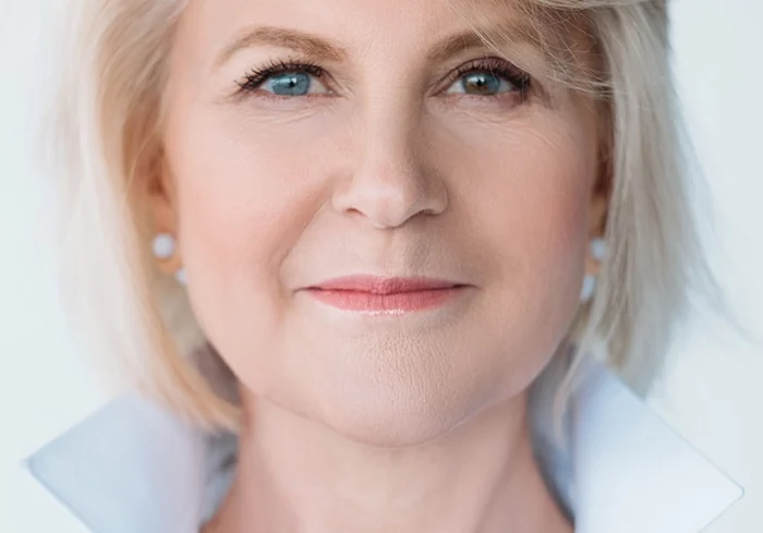 Blepharoplasty-side-1