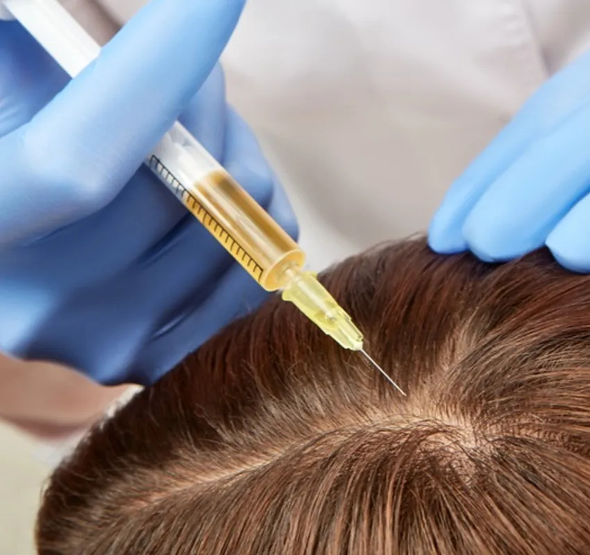 PRP Hair Restoration before and after photo