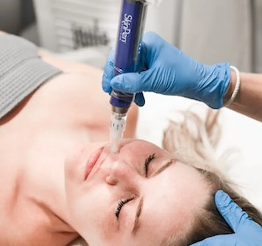 s1-image-new-microneedling